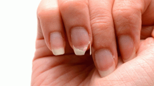 Catálogo para comprar on-line cuidado de uñas quebradizas – Los preferidos