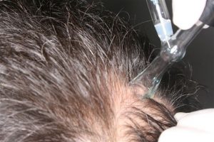 tratamiento caida de pelo disponibles para comprar online – Los más solicitados