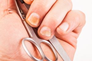 Opiniones y reviews de remedios caseros para el cuidado de las uñas para comprar por Internet – Los Treinta preferidos