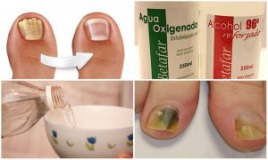 Reviews de crema para uñas de pies para comprar online – Los mejores