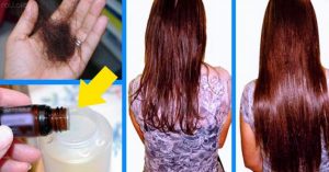 Catálogo de remedios para caida de pelo en mujeres para comprar online